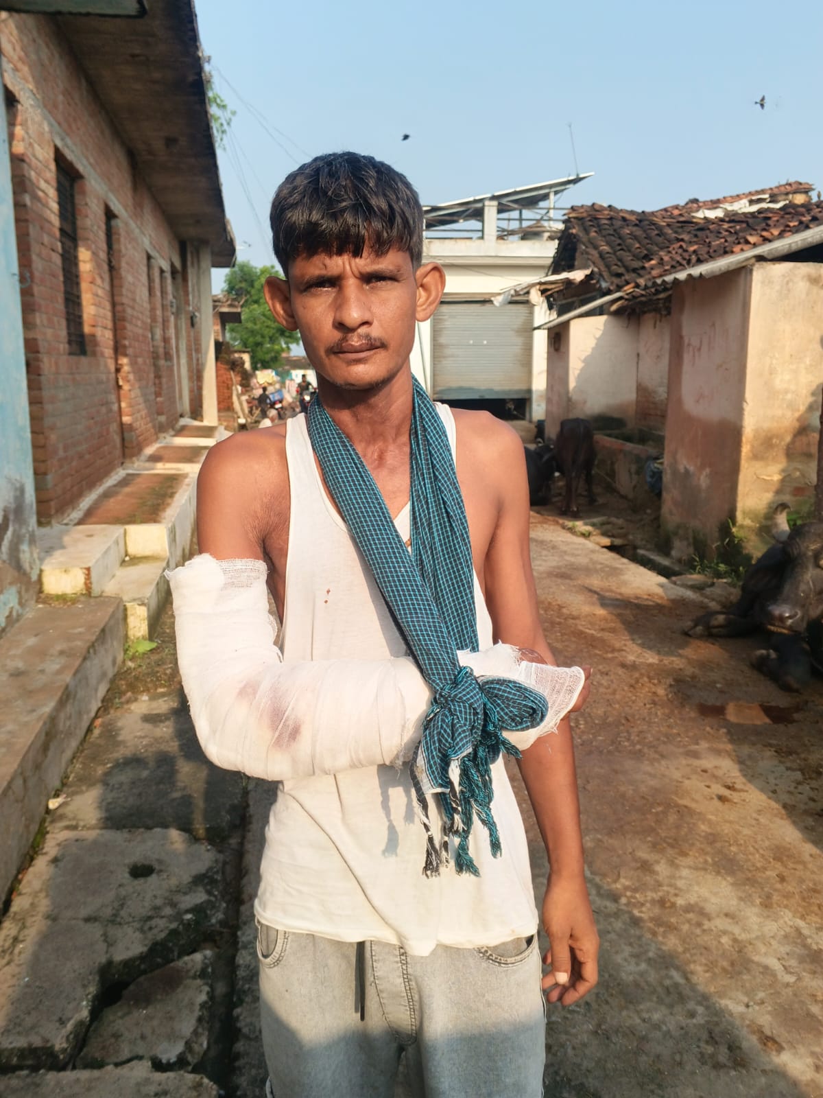 इंगोहटा में आधा दर्जन से अधिक लोगों को बंदरों ने बनाया निशाना, वन विभाग का पिंजरा साबित हुआ बेअसर एक का कानपुर में चल रहा उपचार