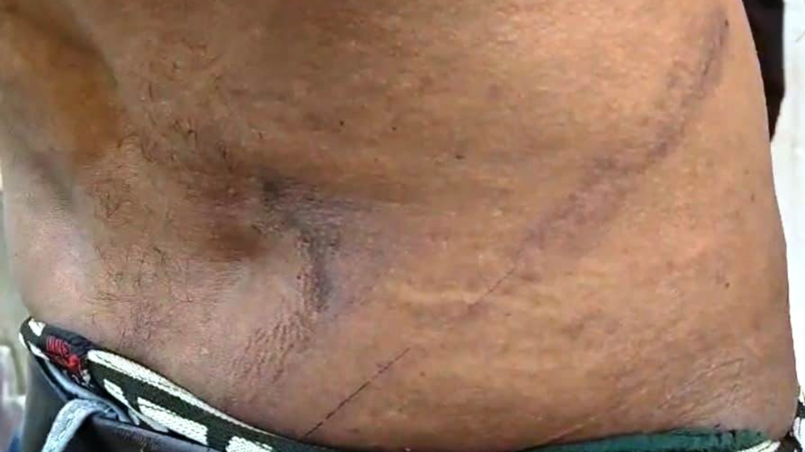 चौकी में बेल्ट चली तो सवालों में आई खाकी, थर्ड डिग्री के आरोप