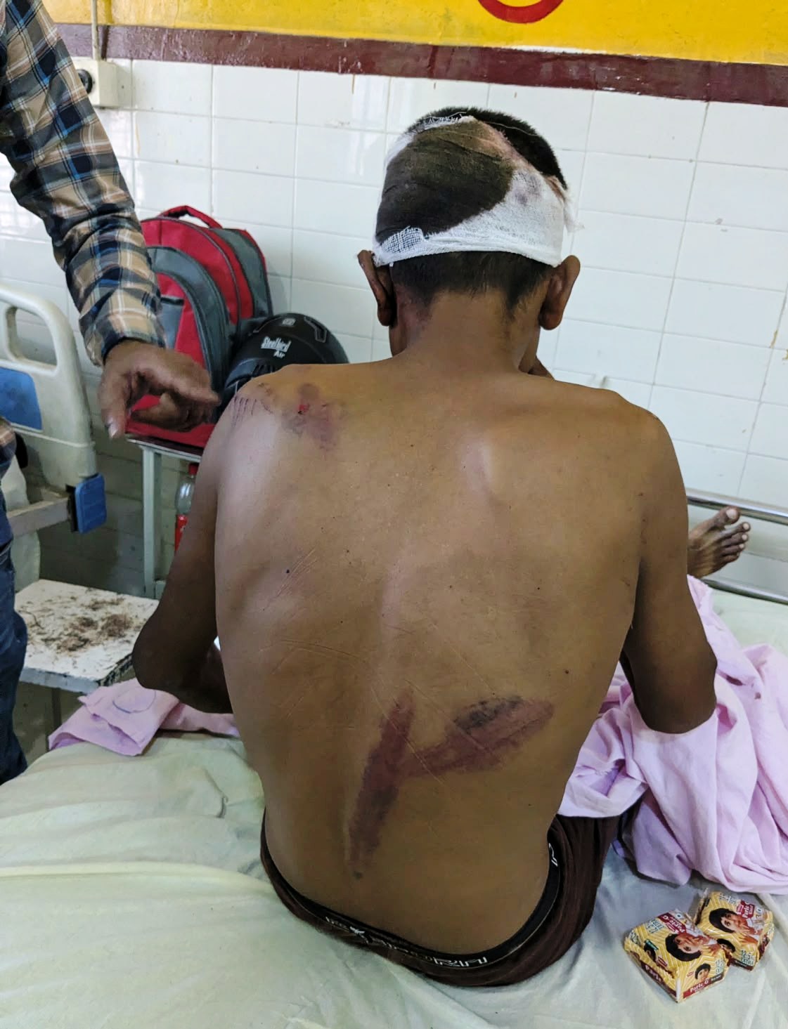 घटतौली की शिकायत की तो जानलेवा हमले का शिकार हुआ युवक