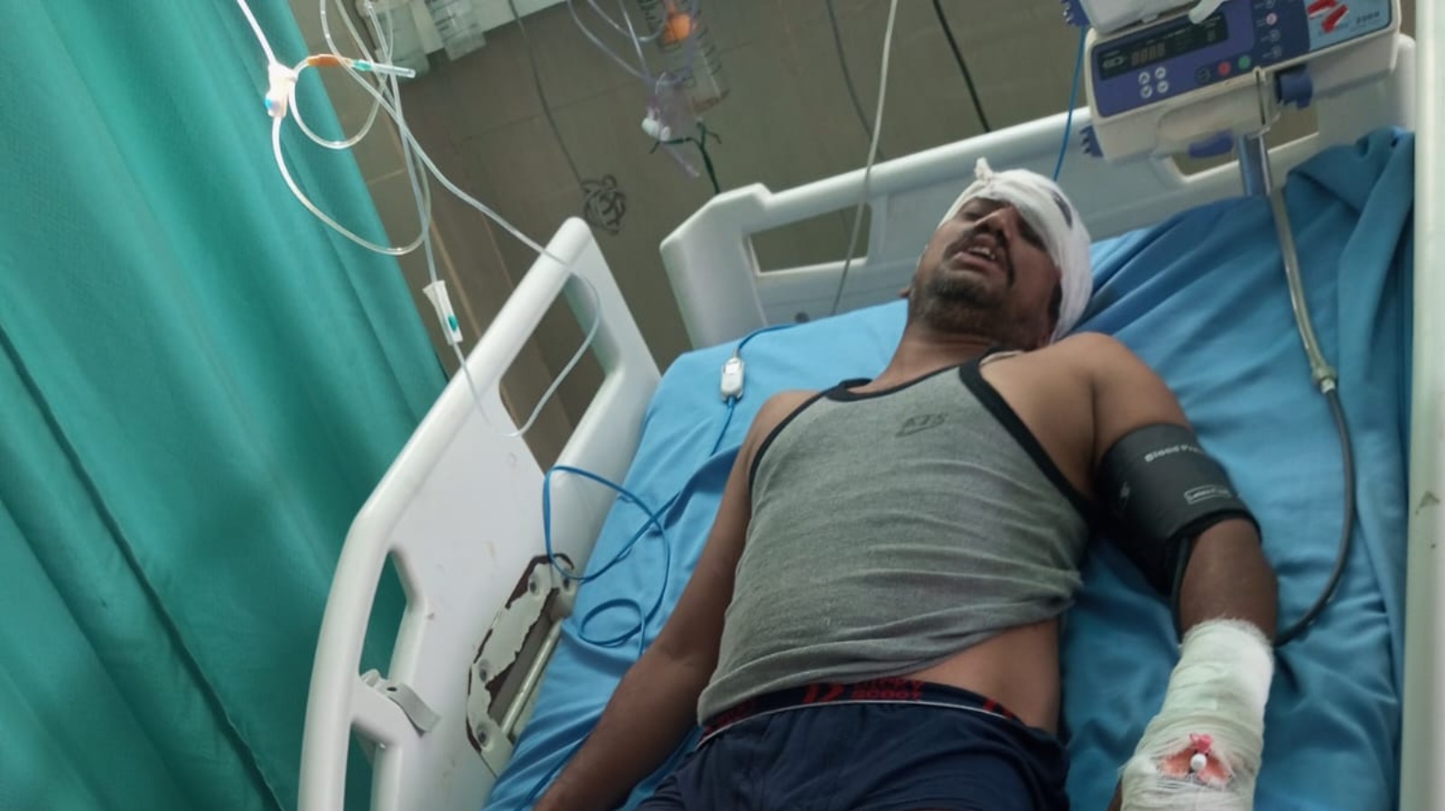 लाइन के पोल पर काम कर रहा लाइनमैन झुलसा