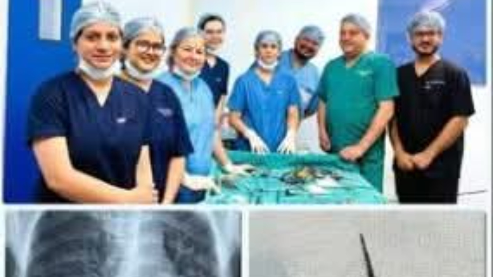 दून अस्पताल के डॉक्टरों ने बचाई तीन मरीजों की जान